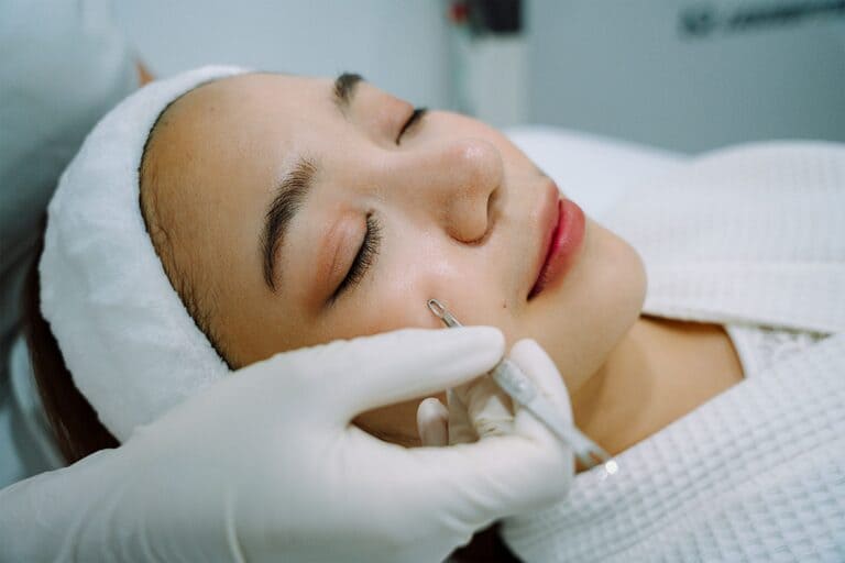 đi spa trị mụn có tốt không, có nên trị mụn ở spa