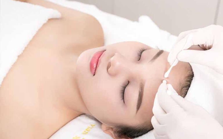 Lý do tại sao nên nặn mụn tại spa