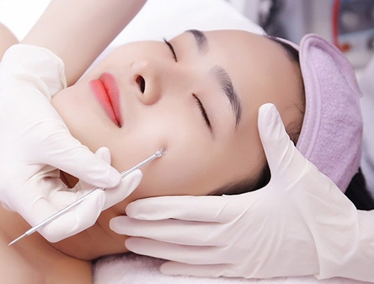 nặn mụn tại quận 7