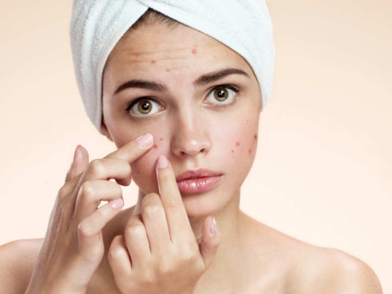 Spa trị mụn quận 9