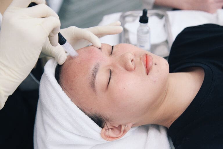 các phương pháp trị thâm mụn tại spa an toàn