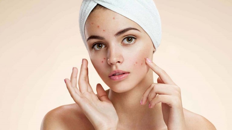 Tác động chống vi khuẩn và ngăn chặn sự hình thành mụn mới