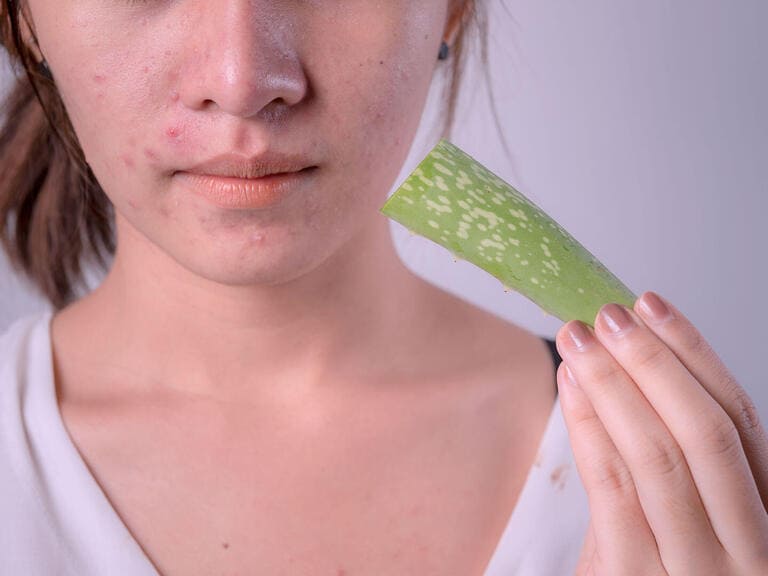cách trị vết đỏ sau khi nặn mụn