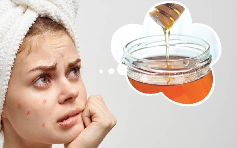 Tại Sao Nên Đắp Mật Ong Sau Khi Nặn Mụn? Cách Thực Hiện