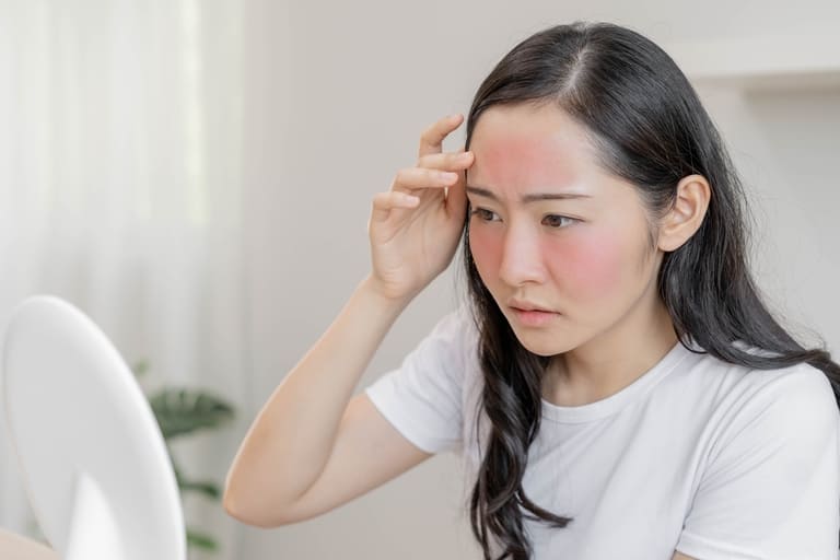 chăm sóc da sau trị thâm mụn