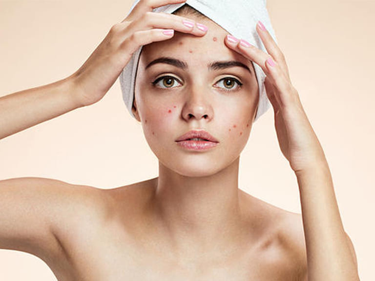 spa nặn mụn quận 8 uy tín