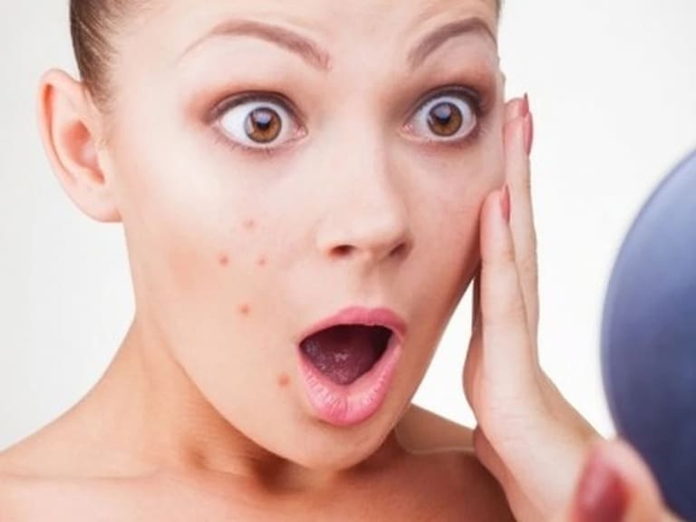 lưu ý khi nặn mụn quận 8