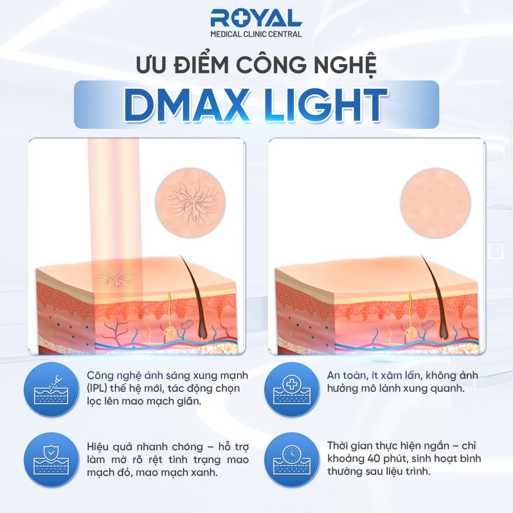 dmax-light