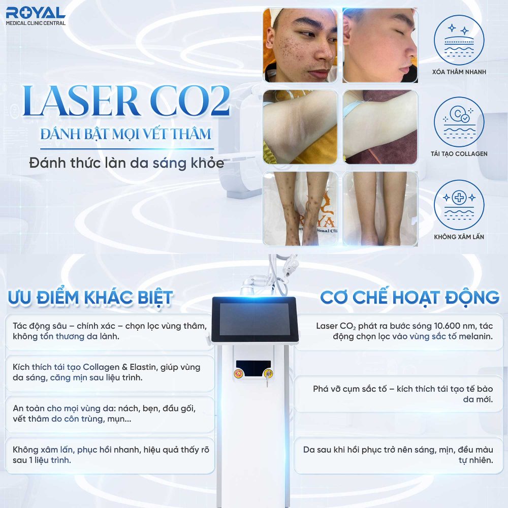 laser