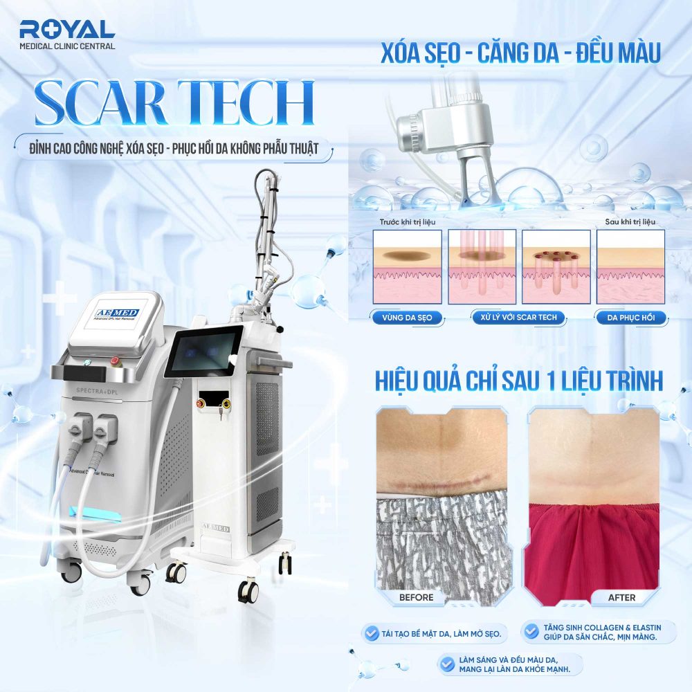 scar